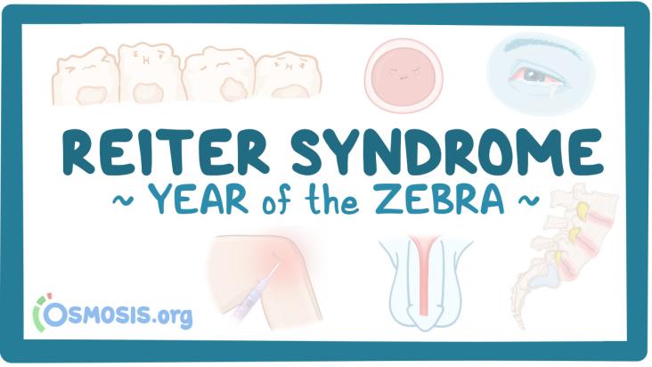 Reiter Syndrome