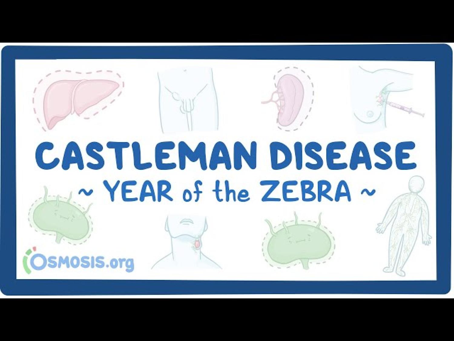 Castleman Disease