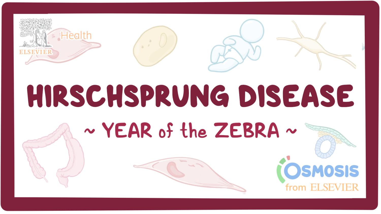 Hirschsprung Disease